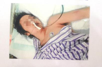 长期遭家暴险自杀&nbsp;自贡女子申请人身安全保护令