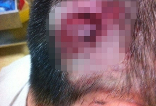 泸州的哥被乘客殴打续：&nbsp;警方正全力抓捕嫌疑人(图5)