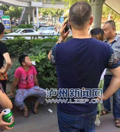 祸从天降！泸州两路人被掉落商铺广告牌砸伤(图1)