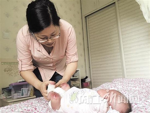 内江女喜得爱女却患怪病&nbsp;轻微摩擦就起水泡(图2)