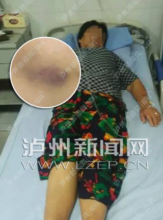 掌掴和脚踢!泸州环卫女工遭“暴力男”殴打(图1) 掌掴和脚踢!泸州环卫女工遭“暴力男”殴打(图1)