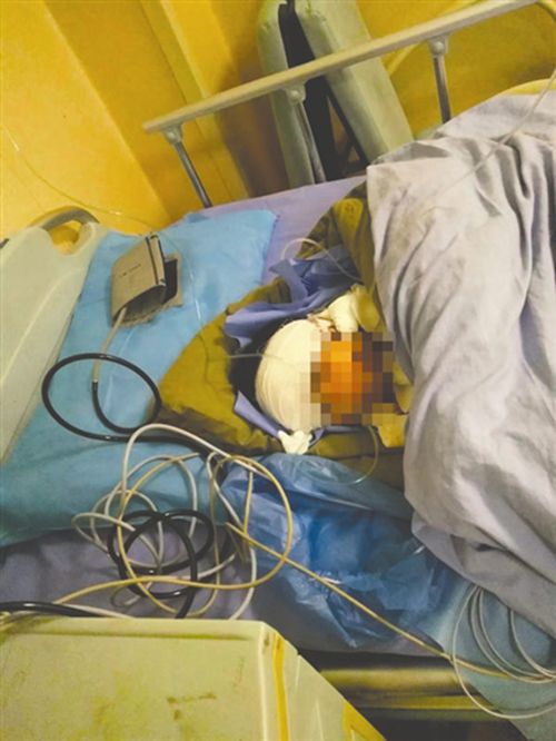 宜宾10岁女童疑因偷钱被剁手指&nbsp;养母自残跳楼(图1)