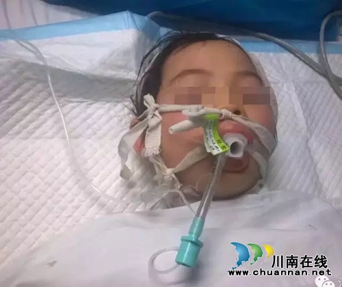 10岁女童被养母砍断气管 西南医大中医院急救!(图1) 10岁女童被养母砍断气管 西南医大中医院急救!(图1)