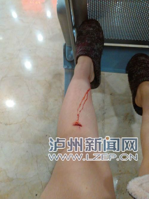 泸州女子晚上回家摔进窨井 市民借来长梯救人(图2) 泸州女子晚上回家摔进窨井 市民借来长梯救人(图2)