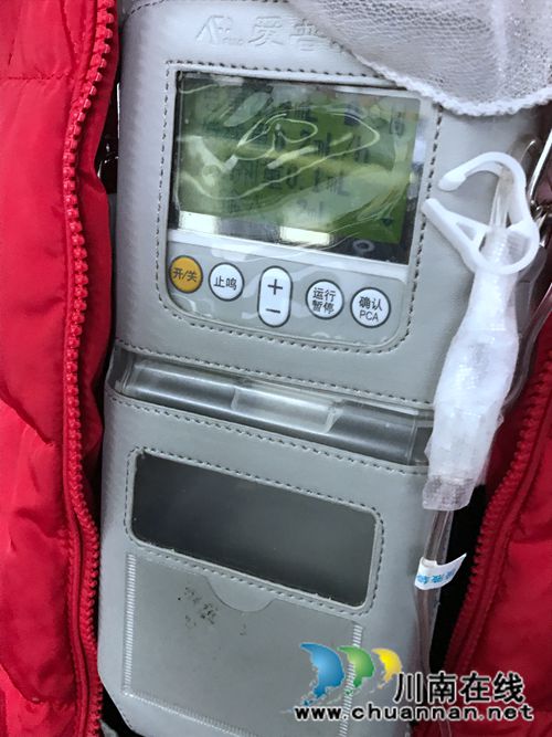 西南医大科大附院首次应用鞘内吗啡泵治疗癌痛(图3) 西南医大科大附院首次应用鞘内吗啡泵治疗癌痛(图3)