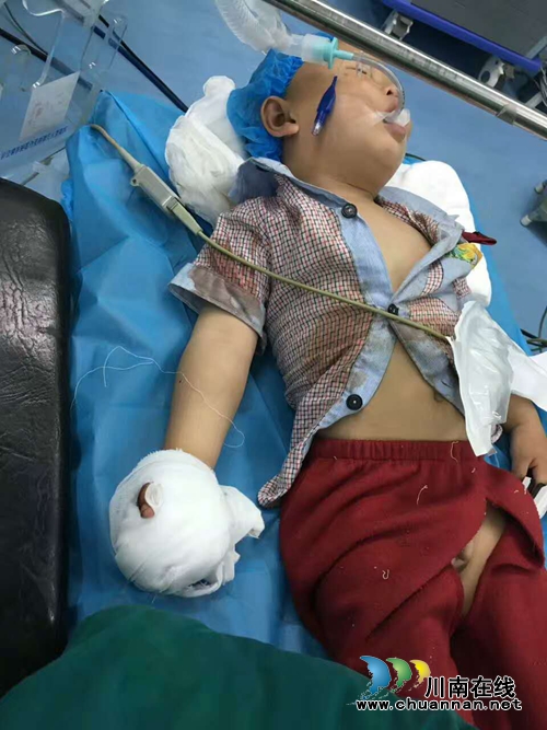 泸州1岁男童右手卷进打米机&nbsp;3根手指断成4截(图1)