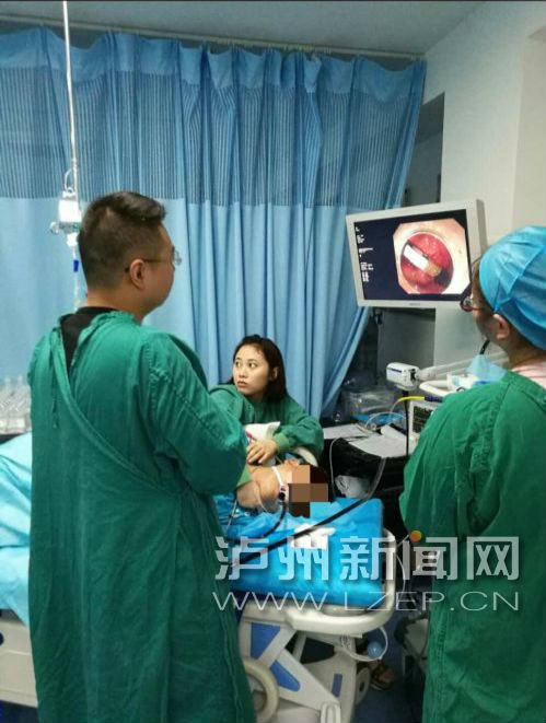 泸州男误吞15厘米长签字笔 医生花45分钟取出(图2) 泸州男误吞15厘米长签字笔 医生花45分钟取出(图2)