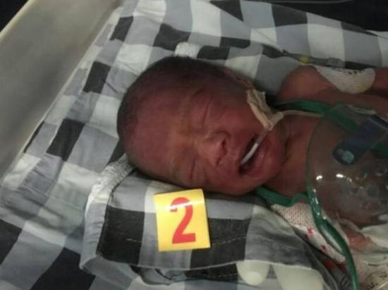 宜宾早产三胞胎加起来才7斤多 随时可能死亡(图1) 宜宾早产三胞胎加起来才7斤多 随时可能死亡(图1)