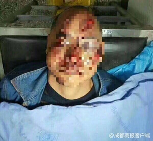 宜宾男骑车遇横祸&nbsp;家属寻肇事者和热心的哥(图1)