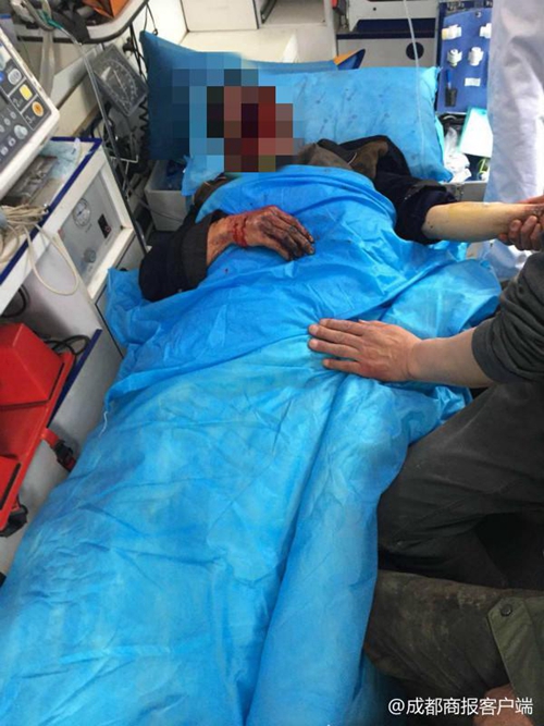 宜宾一村民上山寻中药 遭黑熊袭击被咬烂脸(图3) 宜宾一村民上山寻中药 遭黑熊袭击被咬烂脸(图3)