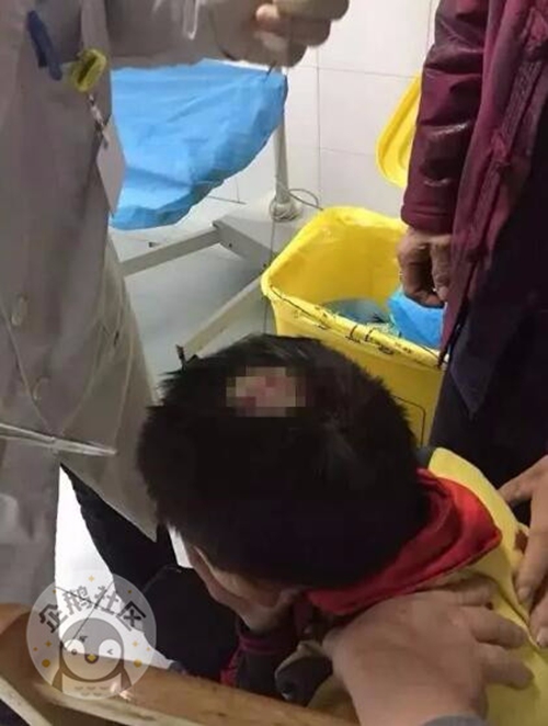 高空飞下“手榴弹” 泸州一学生当场头破血流(图1) 高空飞下“手榴弹” 泸州一学生当场头破血流(图1)