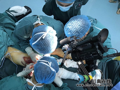 叙永木匠断4指&nbsp;西南医大中医院奋战11小时接活