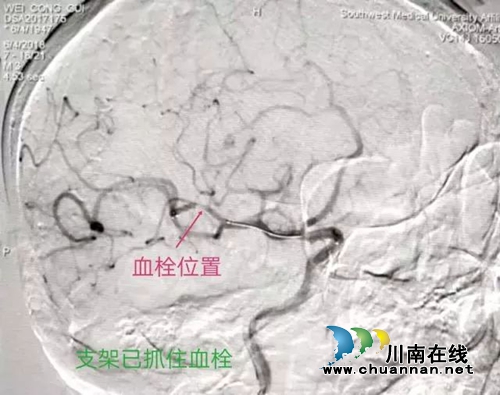 大爷命悬一线 西南医大中医院再演生死时速?(图1) 大爷命悬一线 西南医大中医院再演生死时速?(图1)