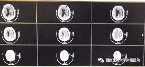 泸州：一通电话一次救助&nbsp;九旬老人转危为安(图5)