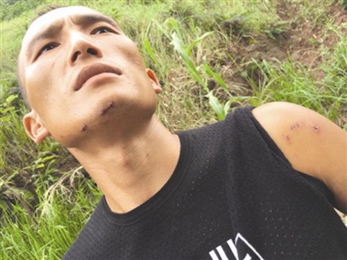 宜宾小伙被恶犬追咬跳江&nbsp;手指夹草呼救50分钟(图1)