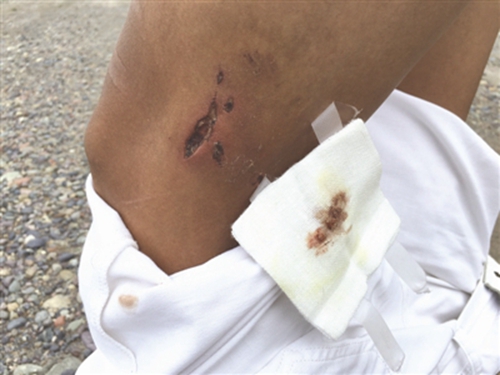 宜宾小伙被恶犬追咬跳江&nbsp;手指夹草呼救50分钟(图3)