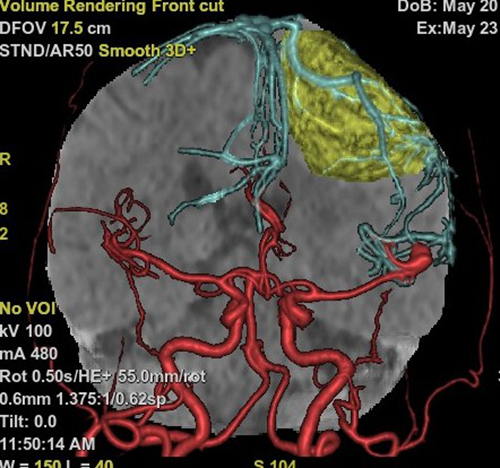 超高端！泸州市人医引进全球顶级CT(图2)