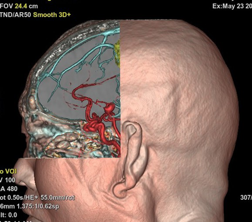 超高端！泸州市人医引进全球顶级CT(图3)