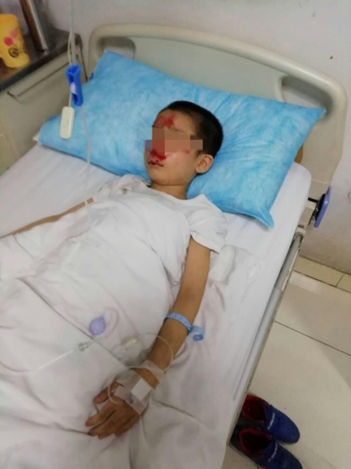 泸州司机撞倒9岁童弃车逃逸&nbsp;路人抬车救人(图2)