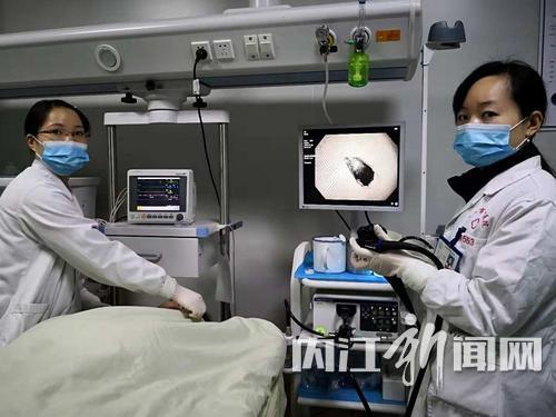 内江女子误吞玻璃碎片疼痛难忍 医生妙手取出(图1) 内江女子误吞玻璃碎片疼痛难忍 医生妙手取出(图1)