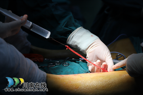 西南医大中医院心胸外科半天内开展三例手术(图7)