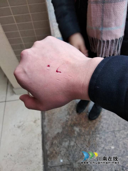 龙马潭:乱写小广告、抓伤警辅 两名女子被处罚(图3) 龙马潭:乱写小广告、抓伤警辅 两名女子被处罚(图3)