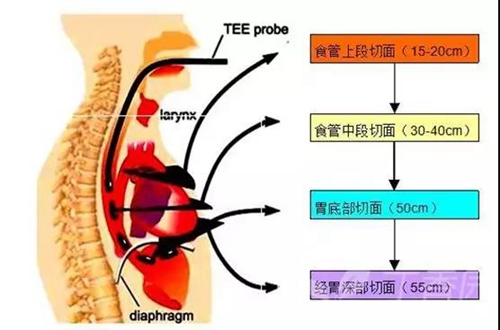 超声心动图检查原来还可以这么精确？(图2)