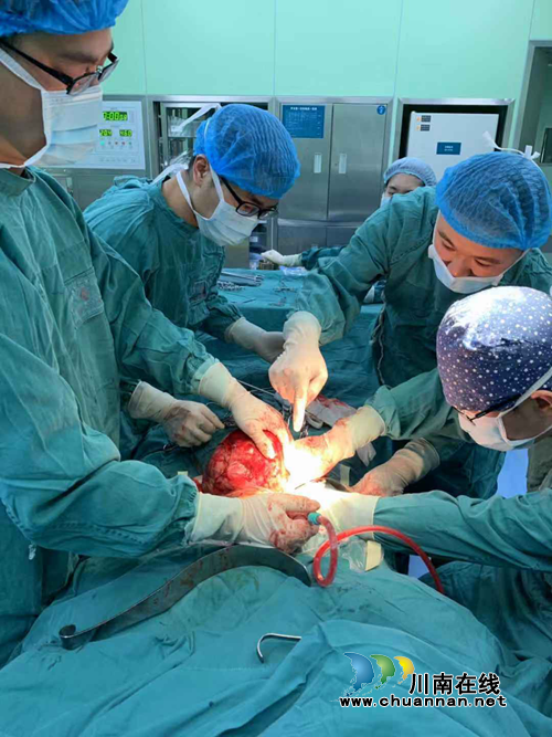 女子“怀胎”3年，竟是6.4斤重的……(图1)