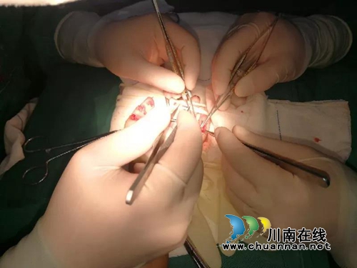 泸州：悲剧上演！绞肉机“吞噬”7岁男童手掌(图4)