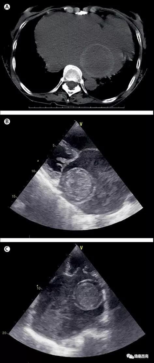 西南医大附院文章登上国际顶级医学期刊(图2) 西南医大附院文章登上国际顶级医学期刊(图2)