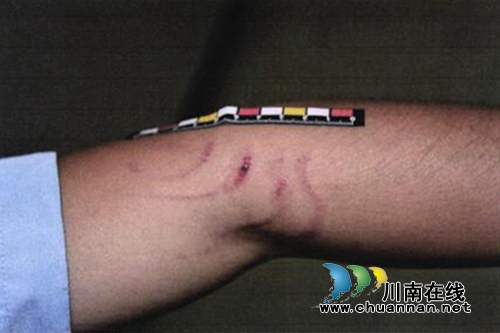 古蔺：三村民阻拦警车还袭警&nbsp;妨害公务获刑(图2)