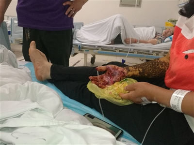 泸州村民被蛇咬伤&nbsp;从成都到泸州紧急送药(图1)