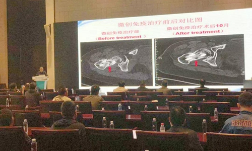 西南医大中医院专家在古都西安闪亮登场!(图10) 西南医大中医院专家在古都西安闪亮登场!(图10)