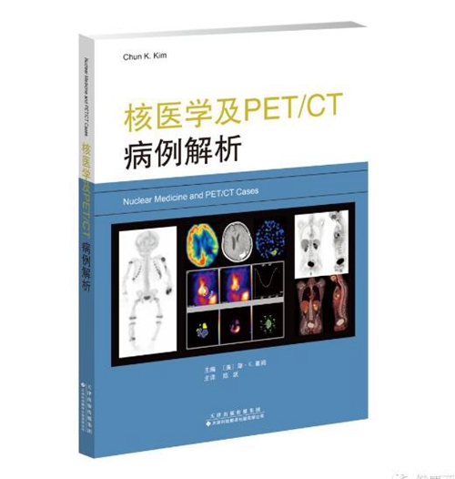 陈跃教授主译的《核医学及PET/CT病例解析》 正式出版发行(图1) 陈跃教授主译的《核医学及PET/CT病例解析》 正式出版发行(图1)