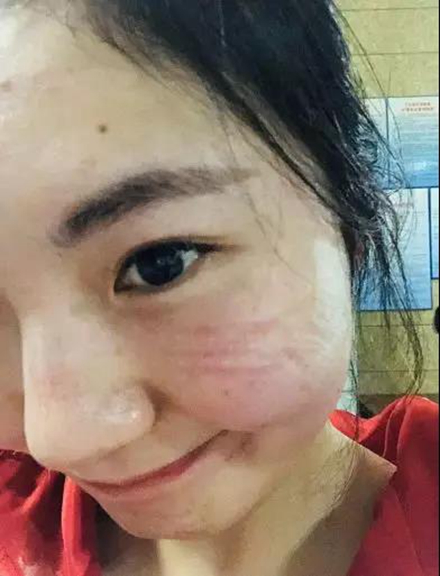 宜宾江安确诊患者治愈出院!10名医护人员解除隔离(图5) 宜宾江安确诊患者治愈出院!10名医护人员解除隔离(图5)