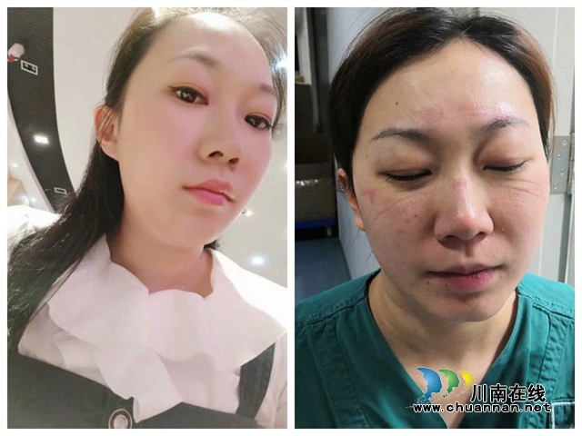 【武汉】西南医大中医院“四朵金花”在隔离病房首次相遇(图10)