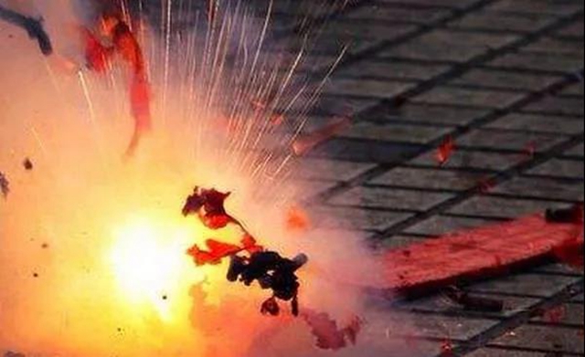 【围观】13岁男孩肚子上长出了一只手？(图3)