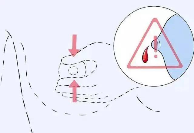 【围观】吃蜂蜜容易患乳腺癌？(图8)