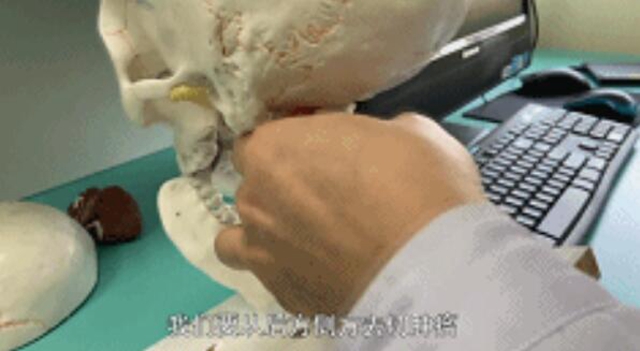 开始只是手指发麻,一查竟是颅内肿瘤!差点就瘫痪……(图4) 开始只是手指发麻,一查竟是颅内肿瘤!差点就瘫痪……(图4)