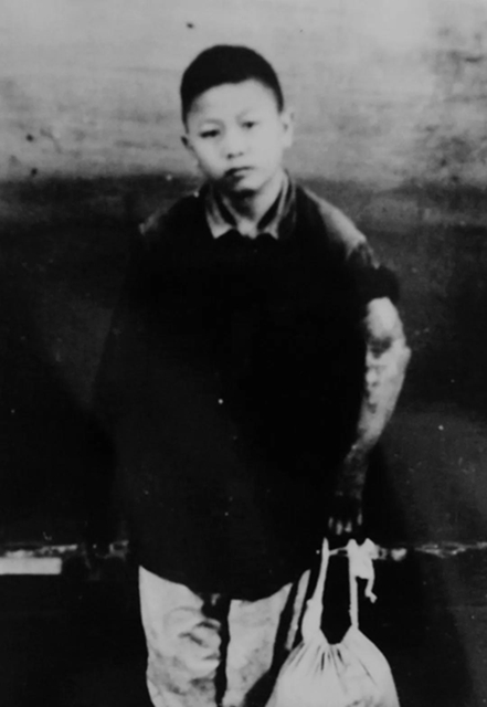 【岁月流金·70年史迹】各种高难度手术，70年代西南医大附院已名扬四海(图5)