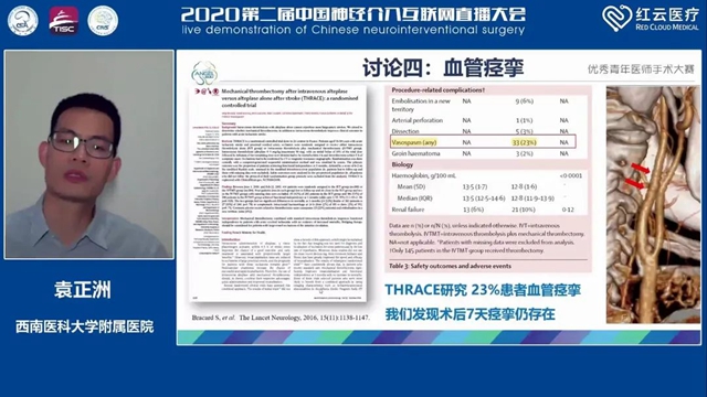 西南医大附院脑卒中团队袁正洲博士再次斩获全国冠军!(图2) 西南医大附院脑卒中团队袁正洲博士再次斩获全国冠军!(图2)