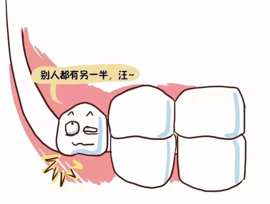 【扩散】智齿，到底该不该拔？(图5)
