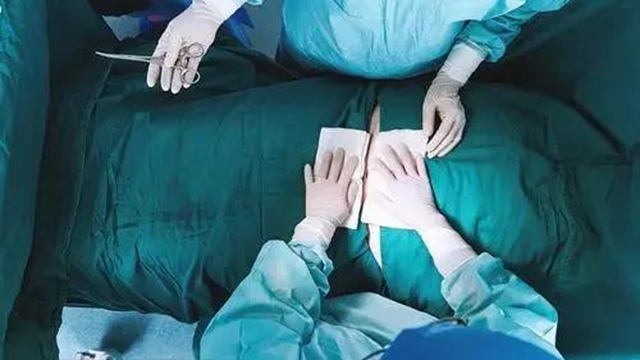 【厉害】指甲盖大小手术切口治疗疝气！(图6)