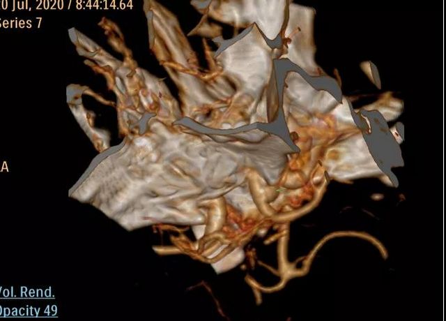 川南地区首家复合手术室在西南医大附院投用(图2)