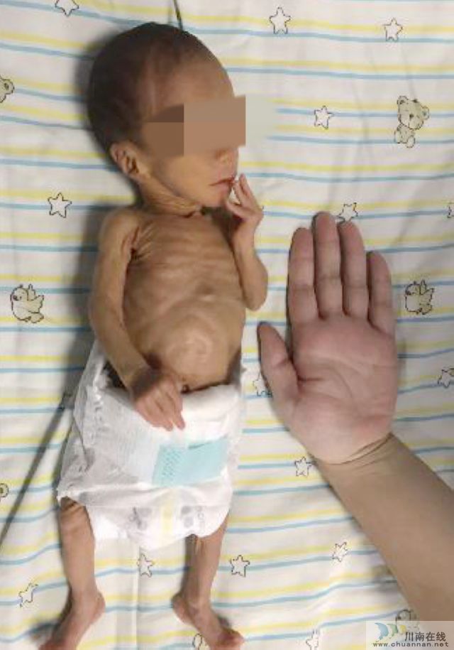 再现手掌宝宝?泸州一宝宝出生时仅2斤!(图2) 再现手掌宝宝?泸州一宝宝出生时仅2斤!(图2)