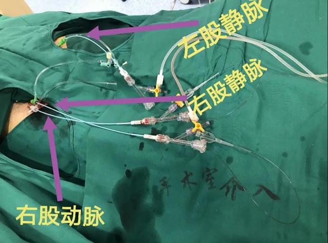 跻身国内先进水平！西南医大附院库欣病诊断技术获突破(图2)