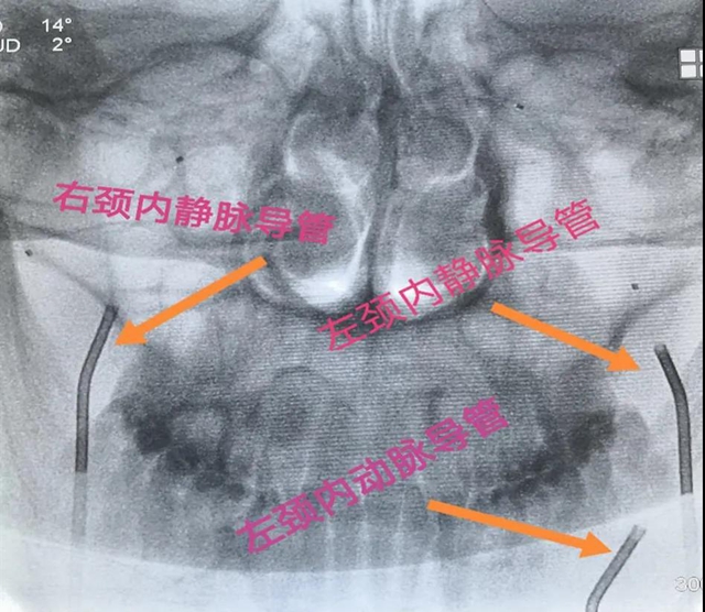 跻身国内先进水平！西南医大附院库欣病诊断技术获突破(图3)