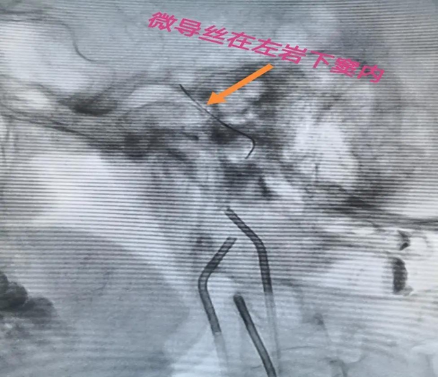 跻身国内先进水平！西南医大附院库欣病诊断技术获突破(图5)