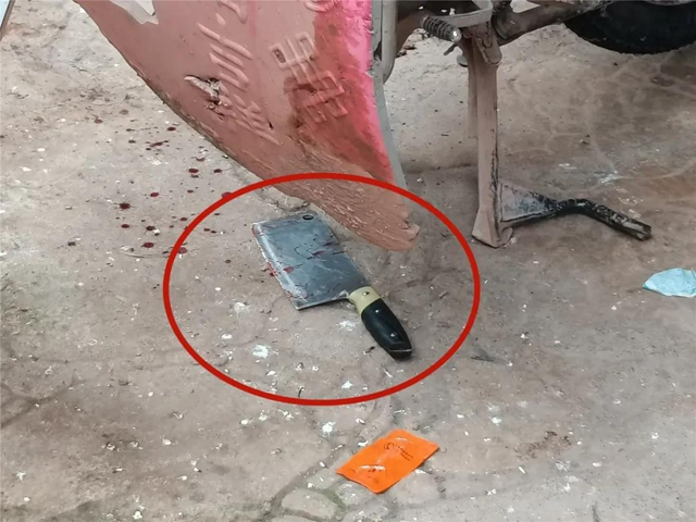 宜宾一男子因爱生恨，提起菜刀将人砍伤……(图2)