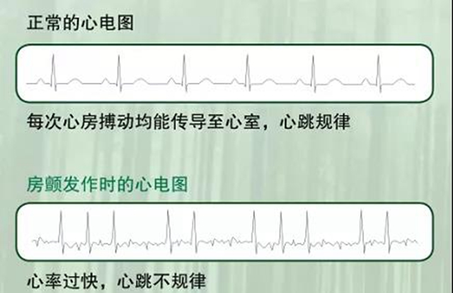 西南医大附院被授予“中国房颤中心”荣誉称号(图3)